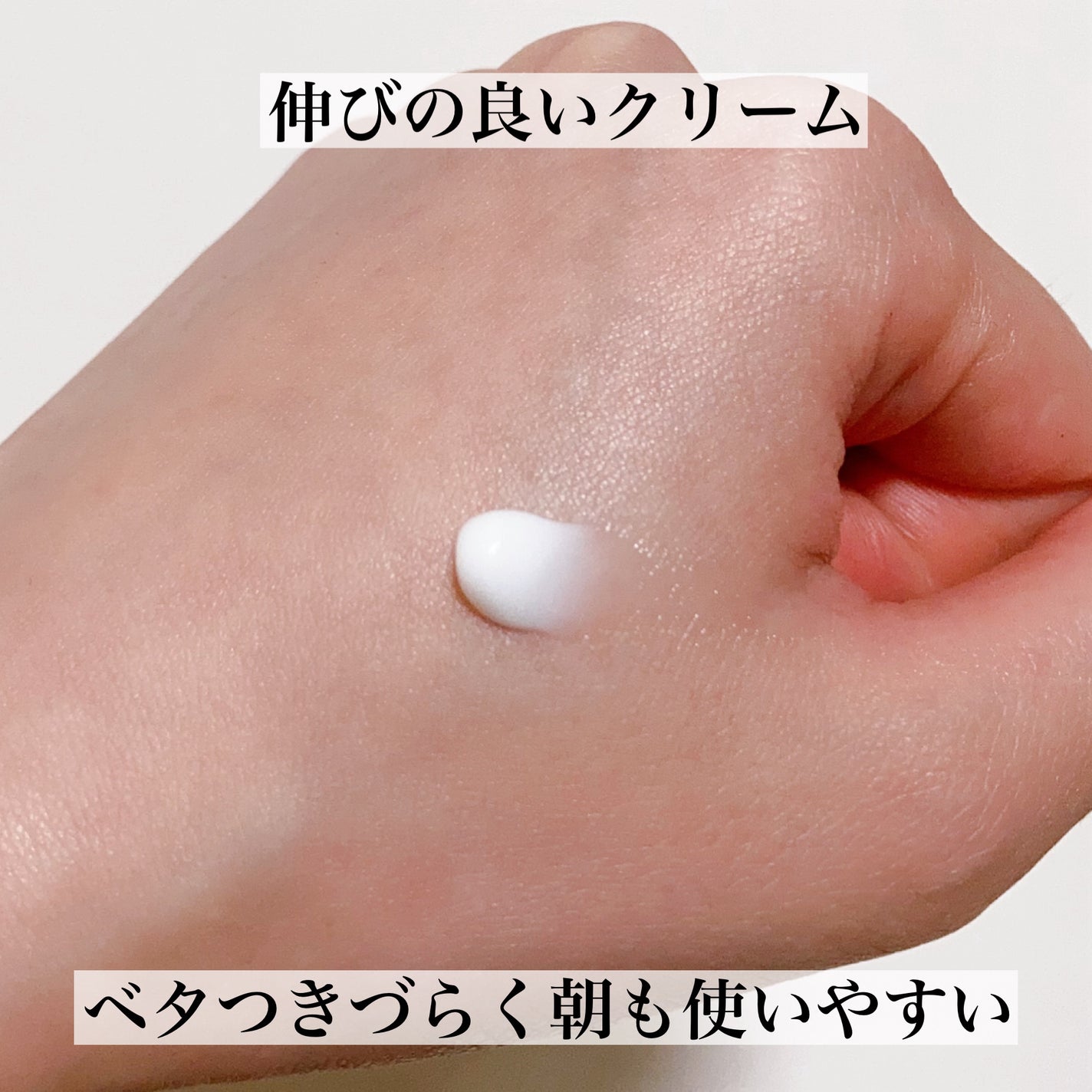 ニキビ治療薬(医薬品)/メンソレータム アクネス/その他を使ったクチコミ(3枚目)