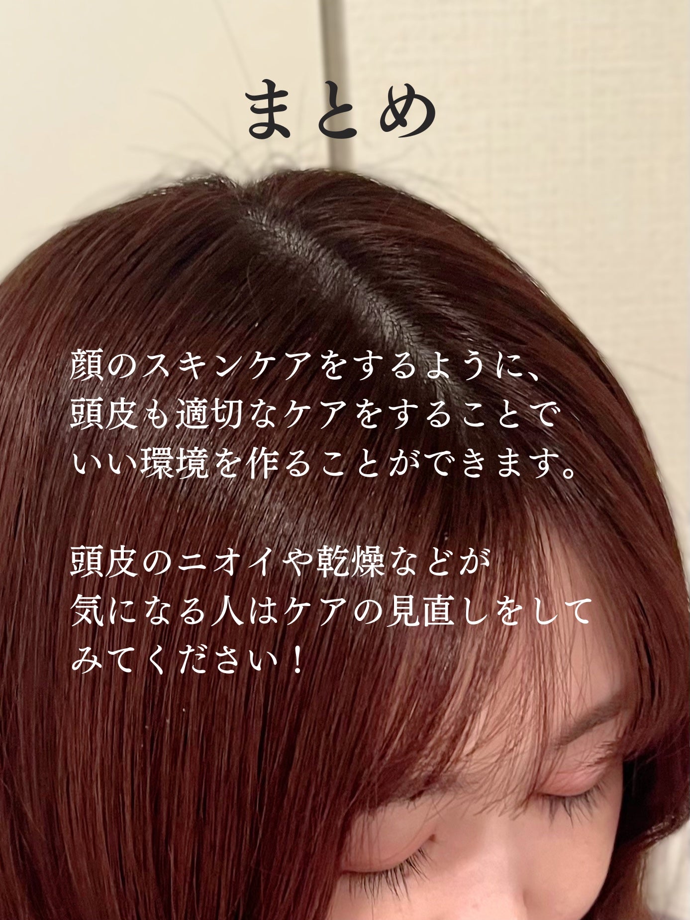 頭皮保湿ローション/キュレル/頭皮ローションを使ったクチコミ(5枚目)