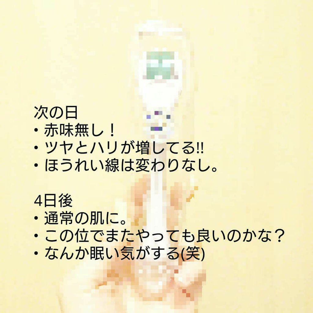 BEBETOXアンプルセット/YOU&ME/スキンケアキットを使ったクチコミ（3枚目）