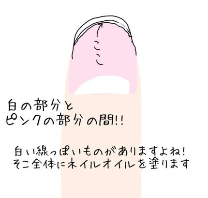 ♡せーにゃん♡🌷 on LIPS 「𓂃美爪への第1歩𓂃ピンクのところが伸びる!!/今回はハイポニキ..」(2枚目)