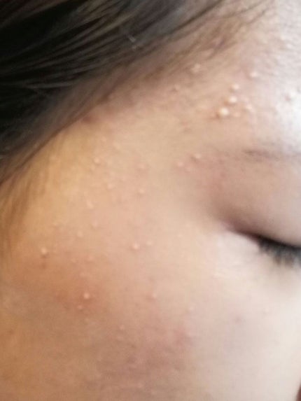 美白化粧水 W しっとりタイプ/ちふれ/化粧水を使ったクチコミ(2枚目)