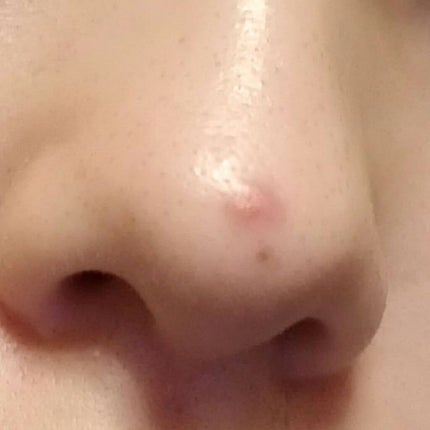 薬用ふわふわな泡洗顔/メンソレータム アクネス/泡洗顔を使ったクチコミ(2枚目)