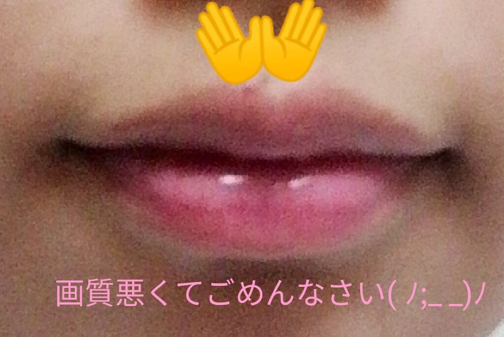 薬用ベビーパウダー/ピジョン/ボディパウダーを使ったクチコミ（1枚目）