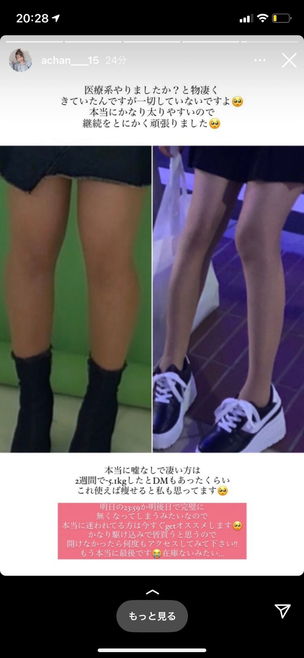 デブ on LIPS 「今日好きの日向まるちゃん推しの人おる!?可愛いよねー!最近痩せ..」(1枚目)