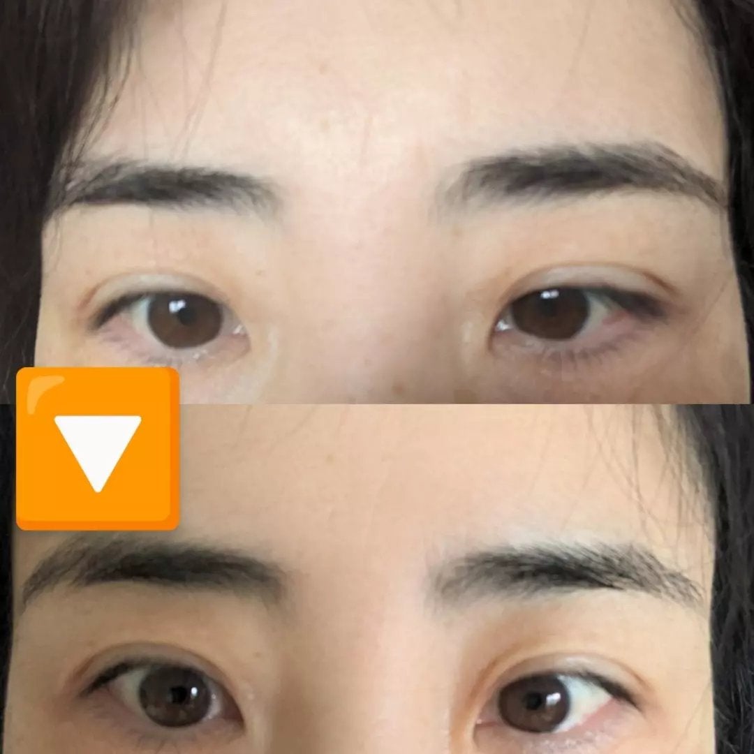 おほあんどうふ on LIPS 「面長のワタシは目元にシワができやすいんですってマスクでも隠れな..」(3枚目)