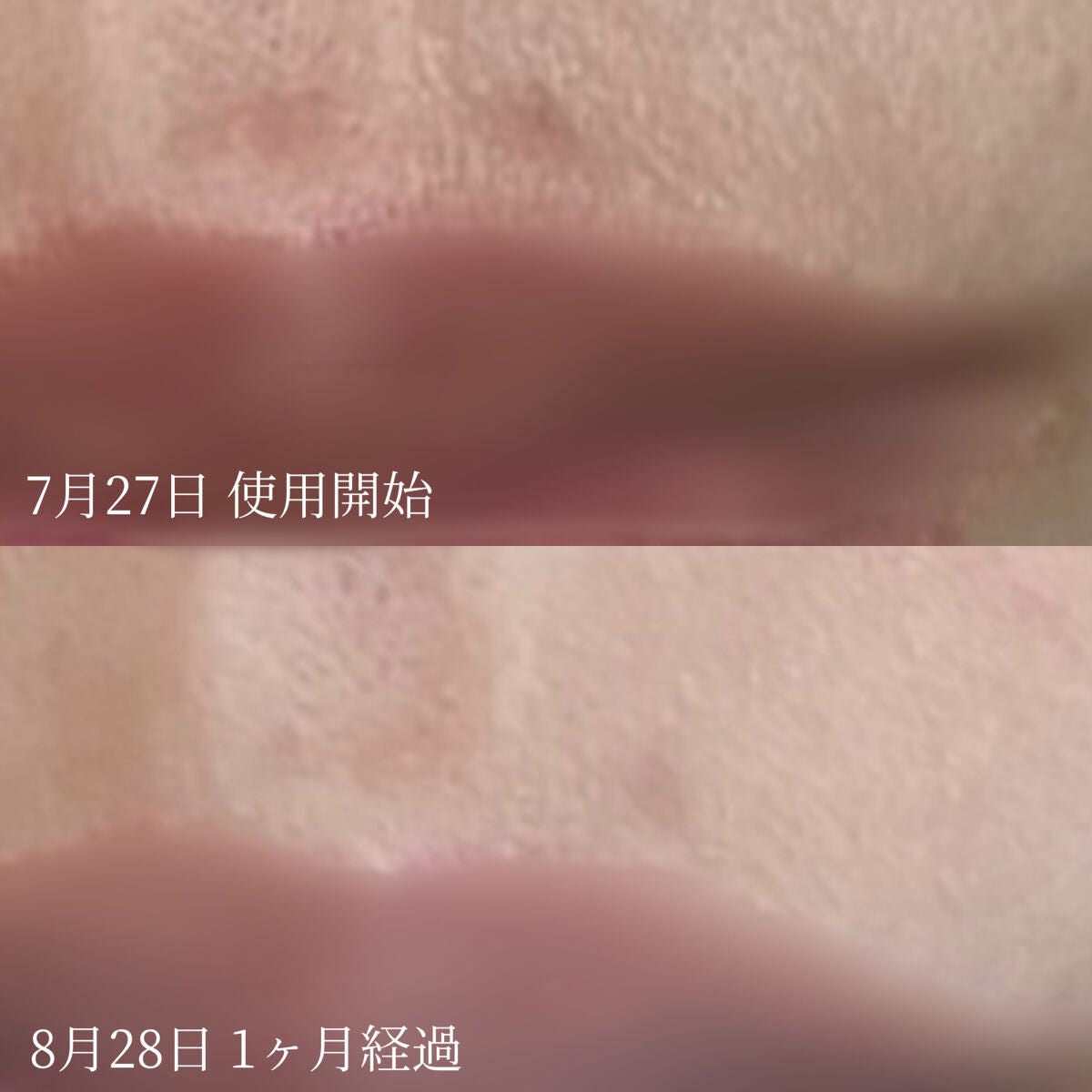 ビタミンC&Eセラム/YEOUTH/美容液を使ったクチコミ(5枚目)