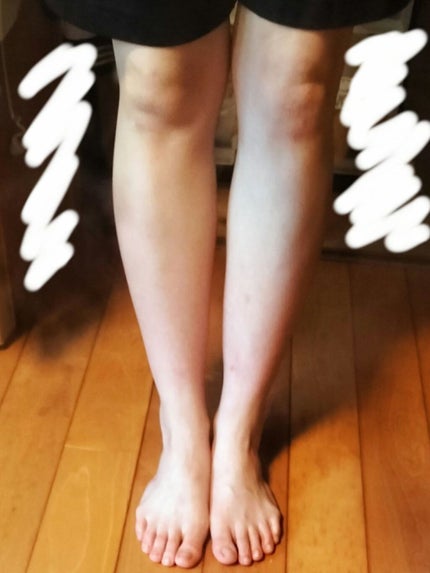 momo ෆ on LIPS 「ひなチャンネル様の脚やせ動画10日目です‼️この動画は、脚やせ..」(1枚目)