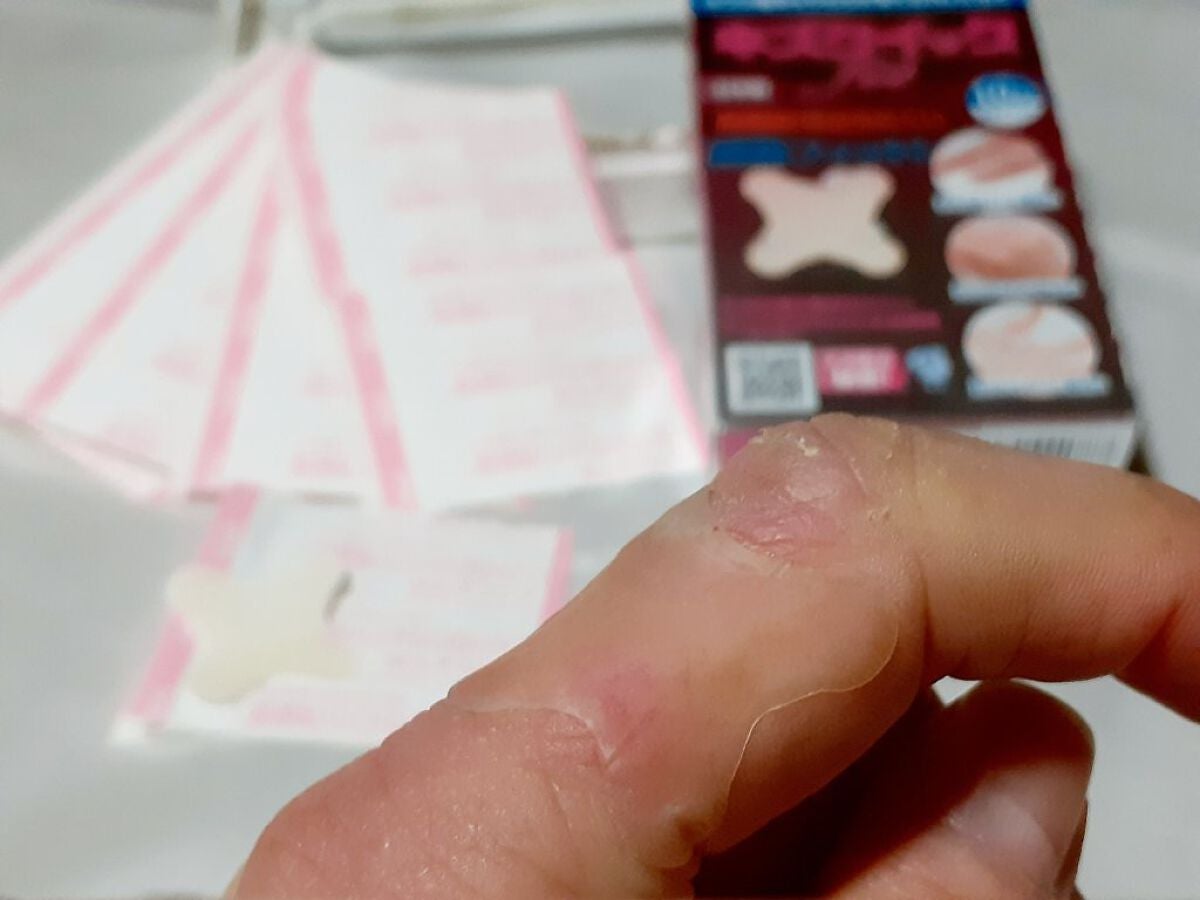 キズクイック/東洋化学/その他を使ったクチコミ(5枚目)