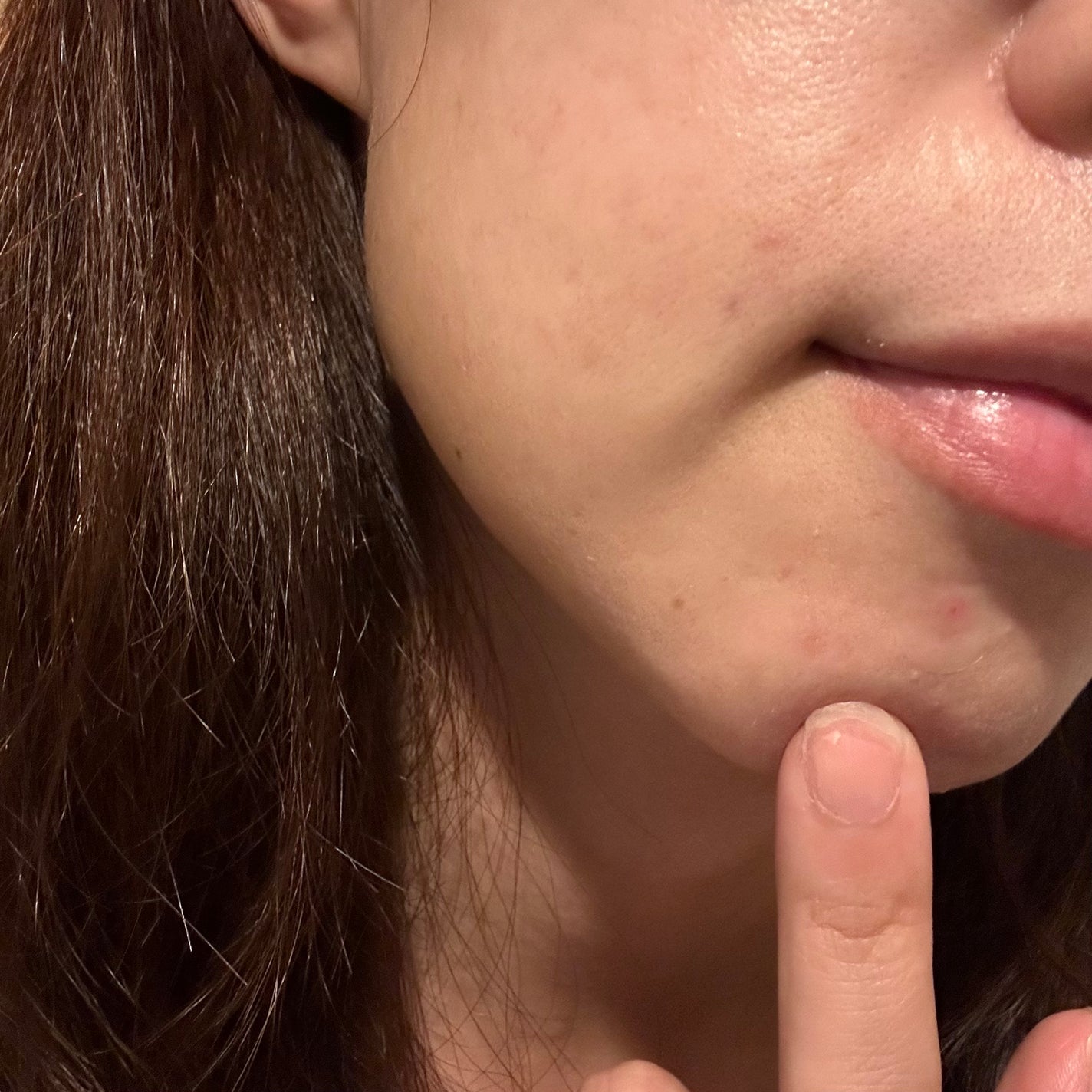 極薄透明パッチ nikipa!/金冠堂/にきびパッチを使ったクチコミ(4枚目)