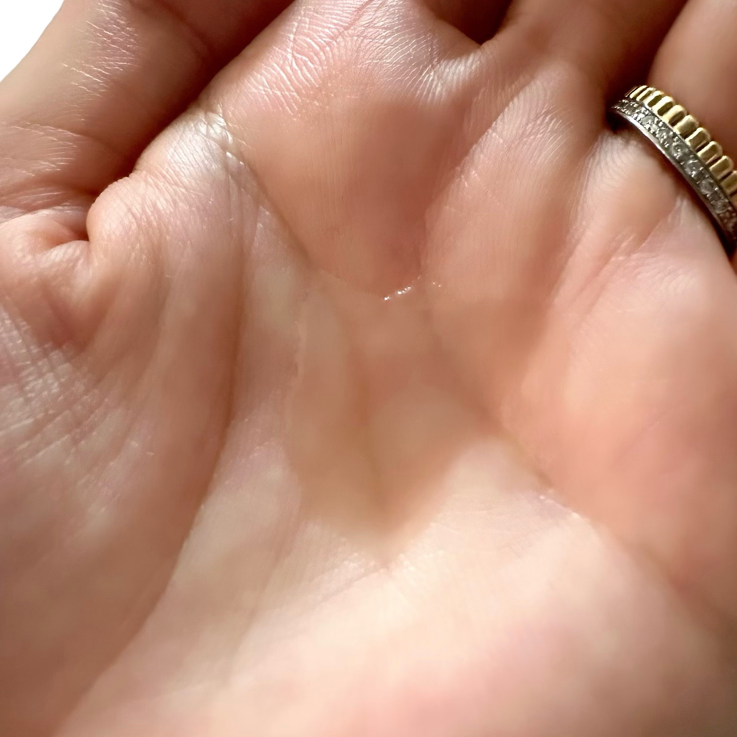 ピンクティーツリートナー/APLIN/化粧水を使ったクチコミ（2枚目）