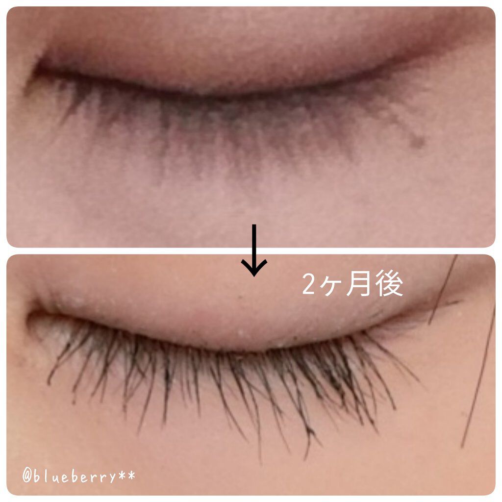 まつげ美容液EX/CEZANNE/まつげ美容液を使ったクチコミ（2枚目）