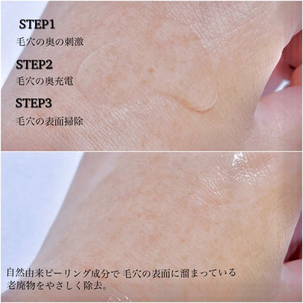 BP-PORE AMPOULE /Dr.Melaxin/美容液を使ったクチコミ(6枚目)