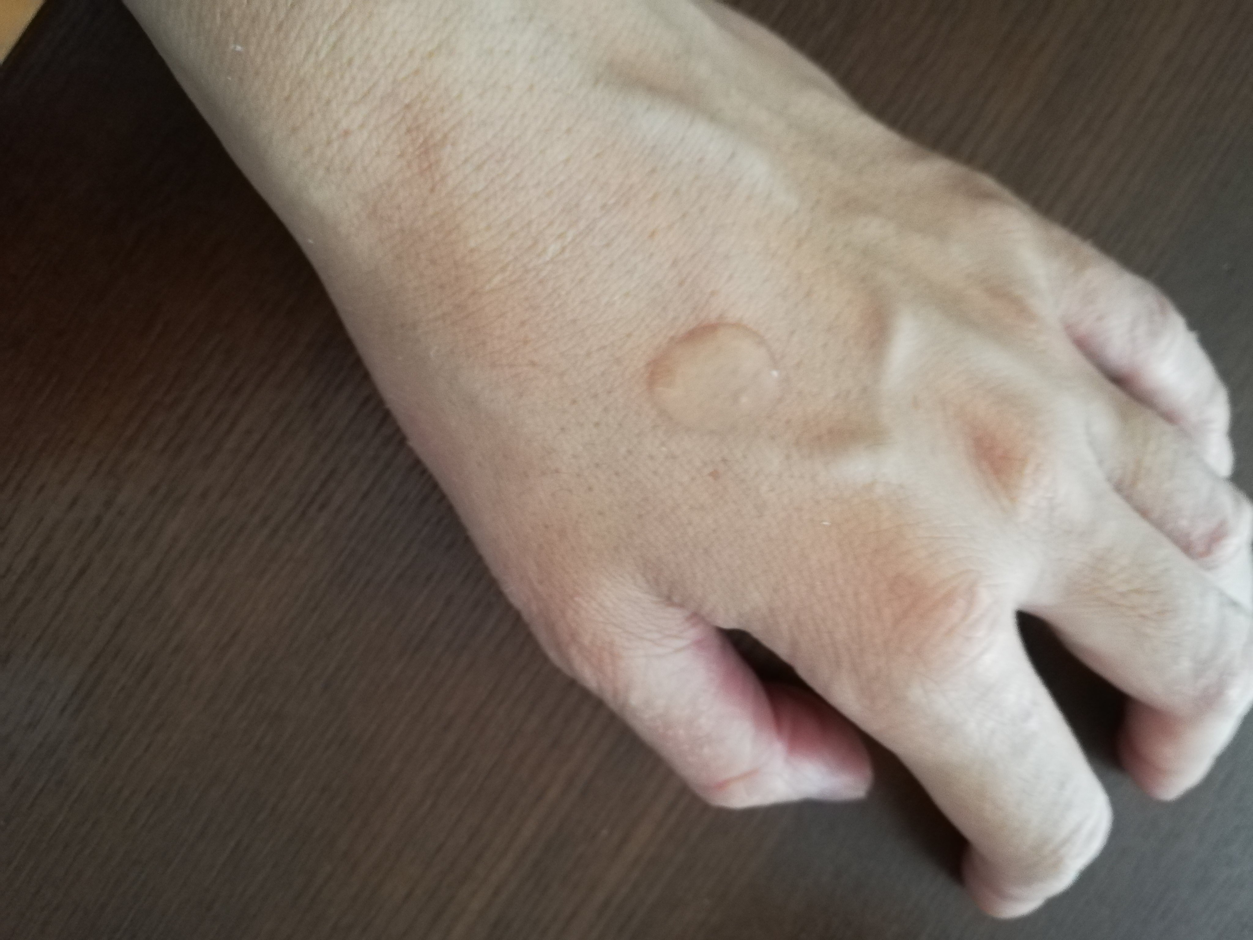 米ぬか水セラム /Beauty of Joseon/美容液を使ったクチコミ（2枚目）