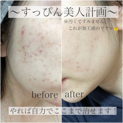 ブラックシュガー パーフェクト エッセンシャル スクラブ2X/SKINFOOD/洗い流すパック・マスクを使ったクチコミ(1枚目)