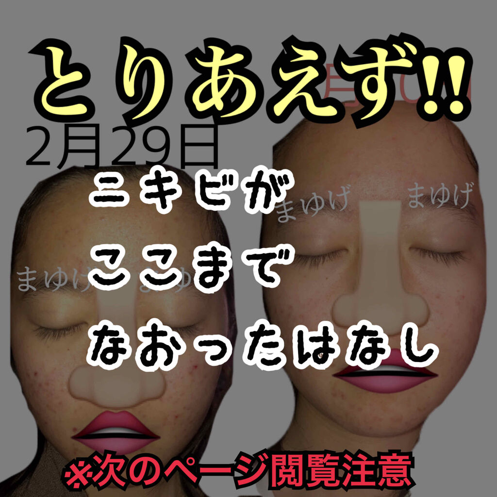 潤浸保湿 フェイスクリーム/キュレル/フェイスクリームを使ったクチコミ（1枚目）