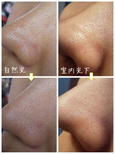 いももち🍓毛穴 on LIPS 「画像3枚目、閲覧注意⚠今回紹介するのはドクターナチュレの「ma..」（3枚目）