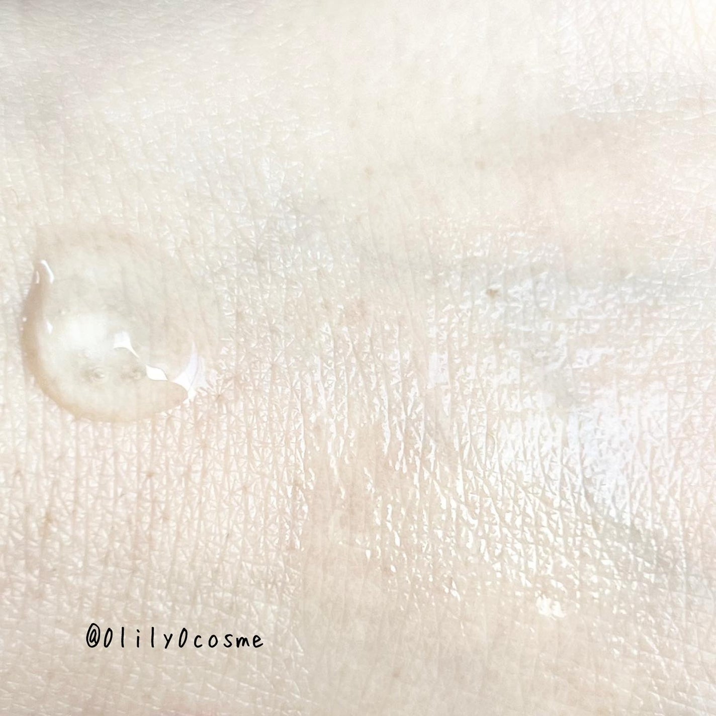 RTXセラム ヒアルショット/Dr.G/美容液を使ったクチコミ(4枚目)