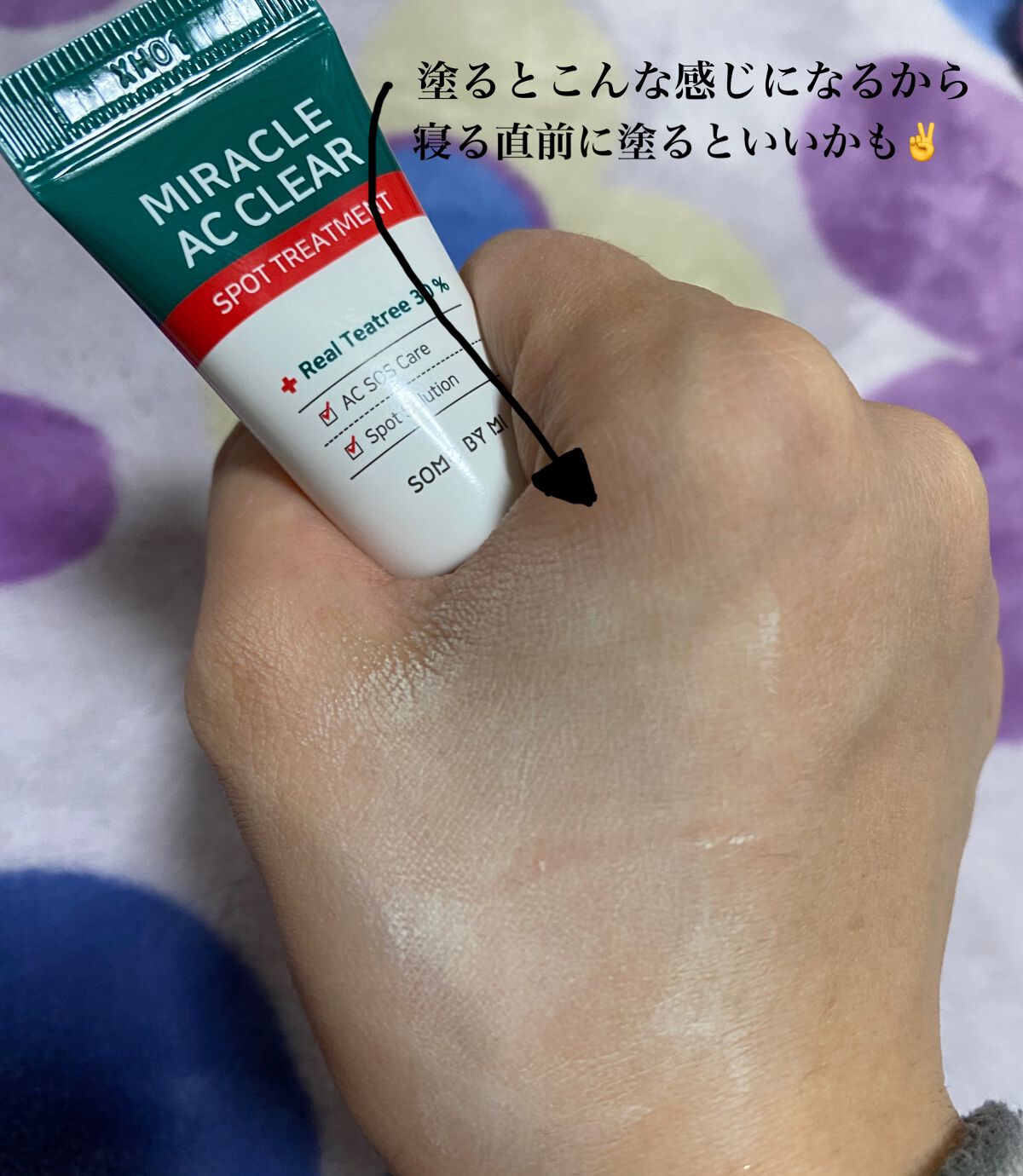 ミラクルアクネクリアスポットトリートメント/SOME BY MI/美容液を使ったクチコミ(3枚目)