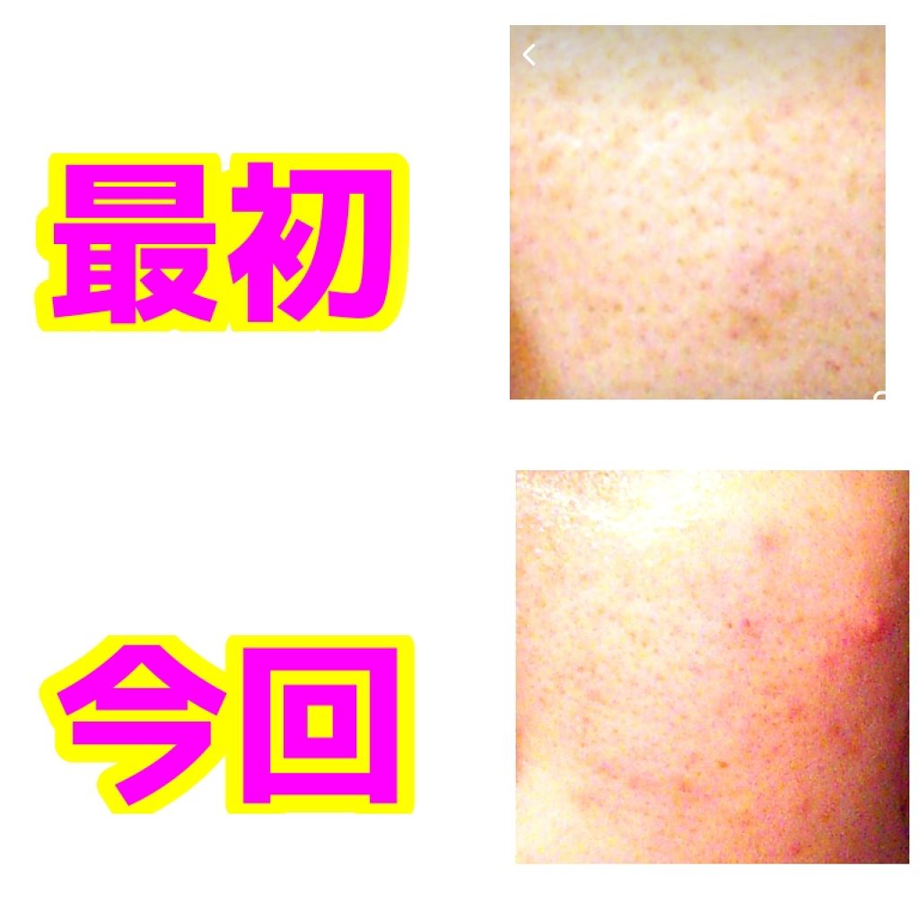 ダイソーパック/DAISO/シートマスク・パックを使ったクチコミ(3枚目)