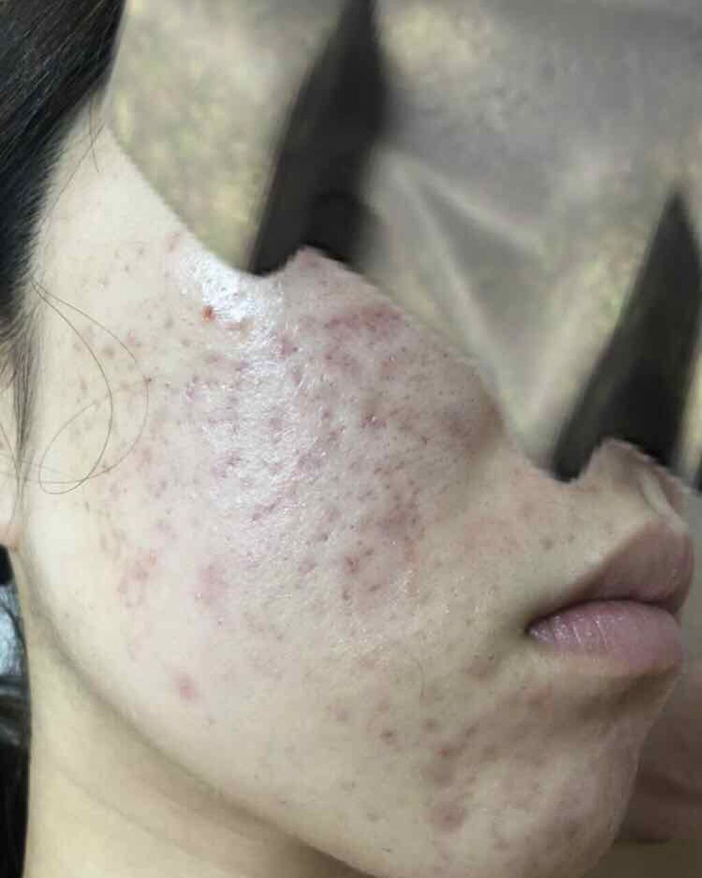 サンシビオ エイチツーオー D/ビオデルマ/クレンジングウォーターを使ったクチコミ（3枚目）