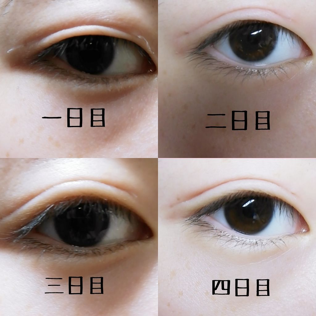 メザイク フリーファイバー120 スタンダードタイプ /メザイク/二重まぶた用アイテムを使ったクチコミ（2枚目）