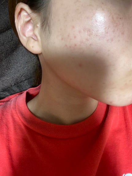 ブライト&バウンシングローション(ノーマルタイプ)/ジュレリッチ/化粧水を使ったクチコミ(2枚目)