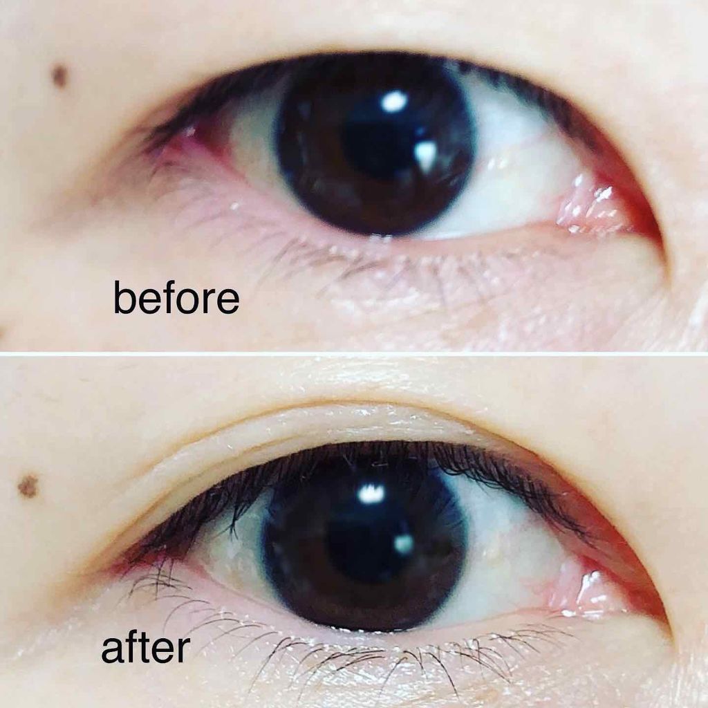 ガールズメーカー エタニティラインα/Girl's Maker/二重まぶた用アイテムを使ったクチコミ(3枚目)