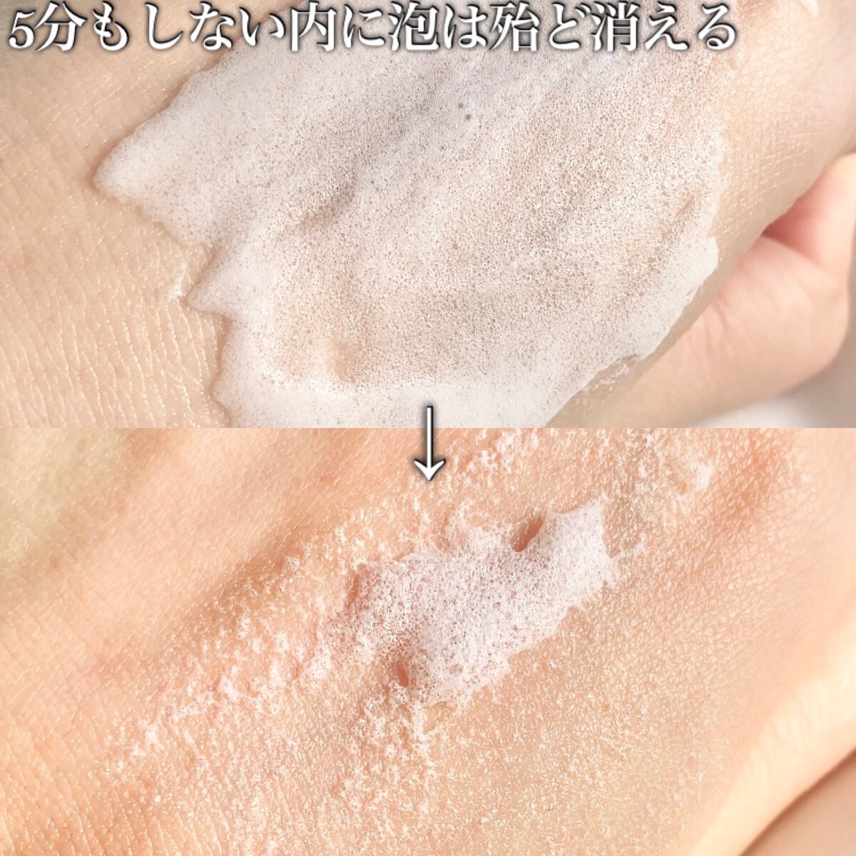 マジックバブルエッセンスパックMINI/BAKER7/シートマスク・パックを使ったクチコミ(5枚目)