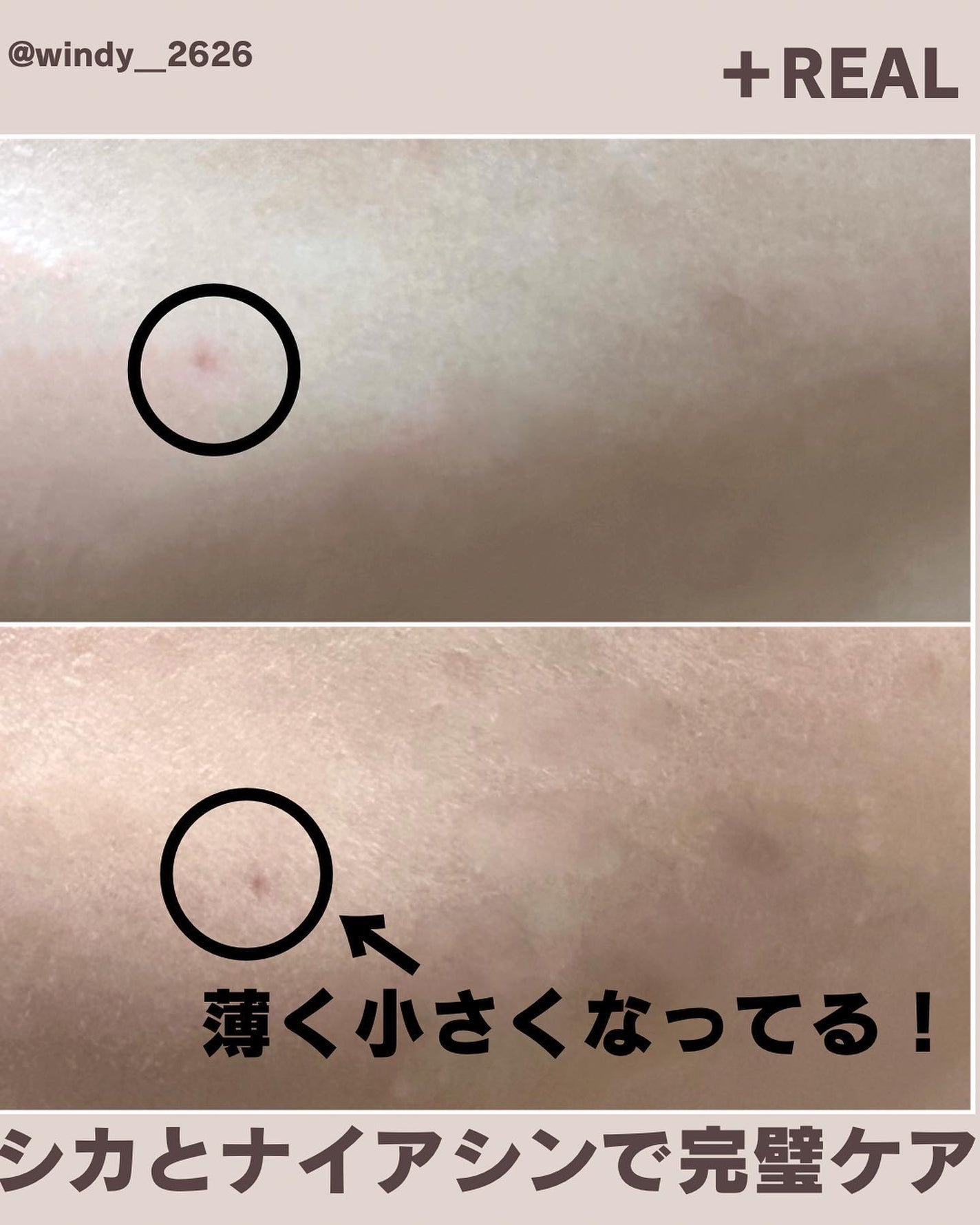 クリアトナー/+REAL/化粧水を使ったクチコミ(6枚目)