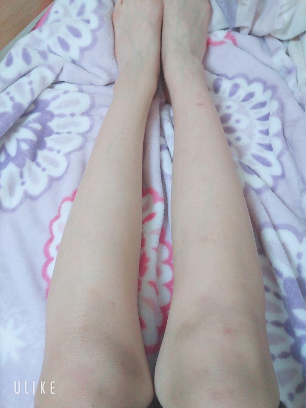 寝ながらメディキュット スパッツ 骨盤テーピング/メディキュット/着圧ソックス・レギンスを使ったクチコミ（2枚目）