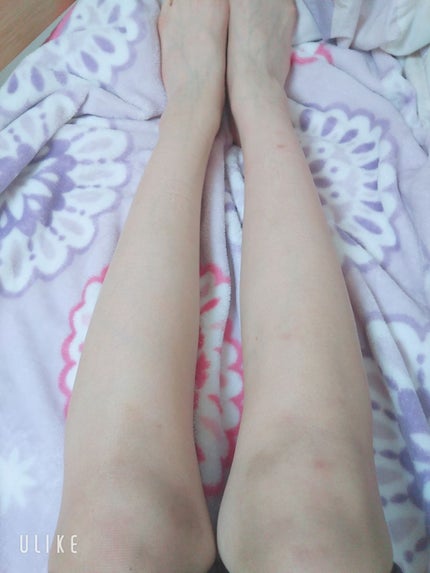 寝ながらメディキュット スパッツ 骨盤テーピング/メディキュット/着圧ソックス・レギンスを使ったクチコミ(2枚目)