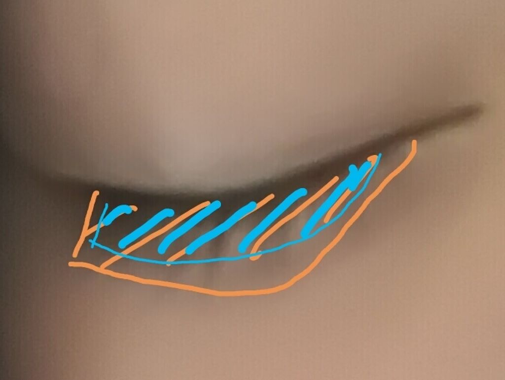 ローヤルゼリー配合 栄養ローション/DAISO/美容液を使ったクチコミ(3枚目)