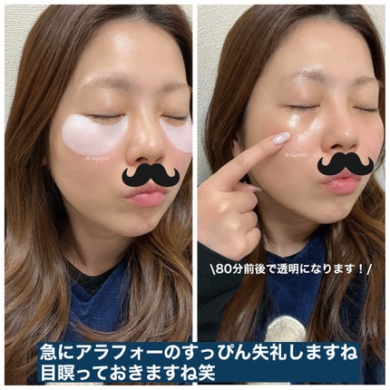 プロバイオダーム コラーゲン リモデリング アイパッチ/BIOHEAL BOH/アイケア・アイクリームを使ったクチコミ(3枚目)