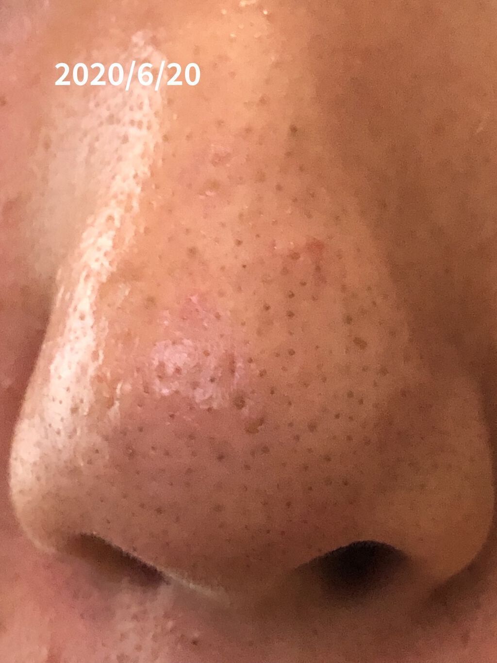 明色美顔水 薬用化粧水/美顔/化粧水を使ったクチコミ（2枚目）