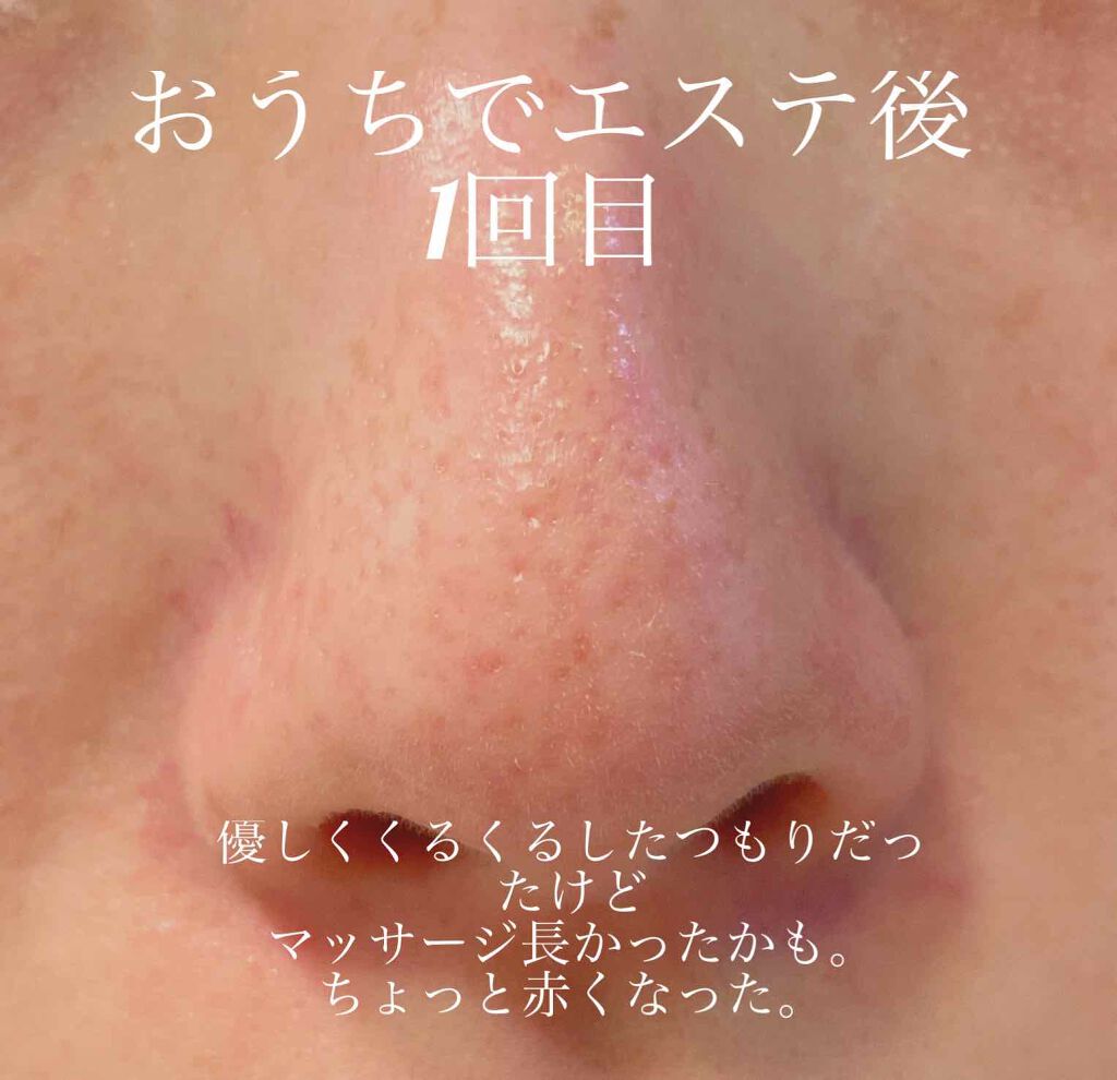 ミセラークレンジングシート セラムモイスト/ビフェスタ/クレンジングシートを使ったクチコミ(4枚目)