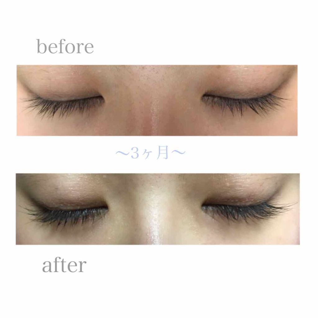 EMAKED(エマーキット)/水橋保寿堂製薬/まつげ美容液を使ったクチコミ(2枚目)