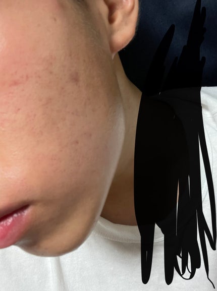 ハトムギ化粧水(ナチュリエ スキンコンディショナー R )/ナチュリエ/化粧水を使ったクチコミ(1枚目)