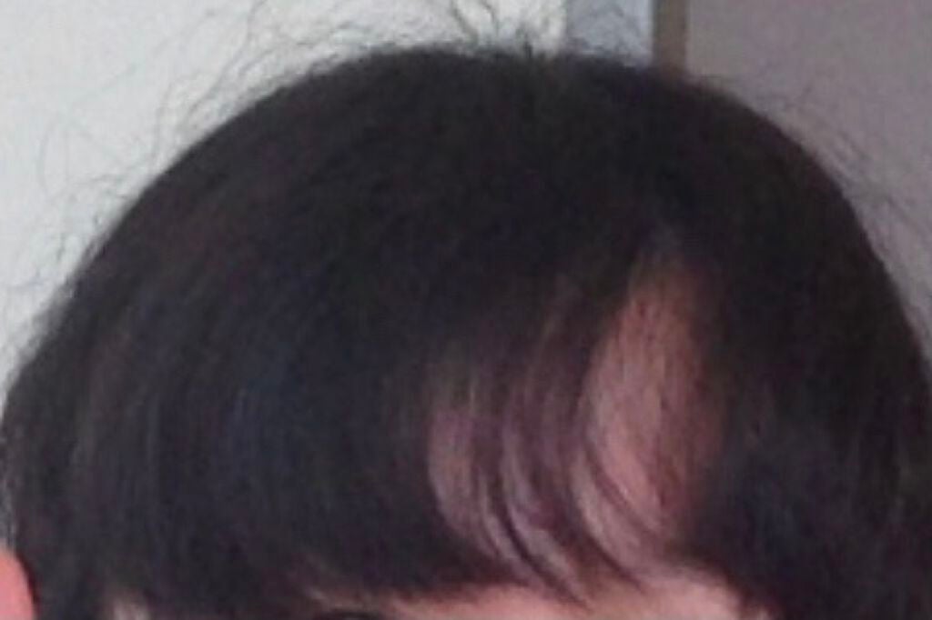 ロレッタ ベースケアオイル/ロレッタ/ヘアオイルを使ったクチコミ(3枚目)