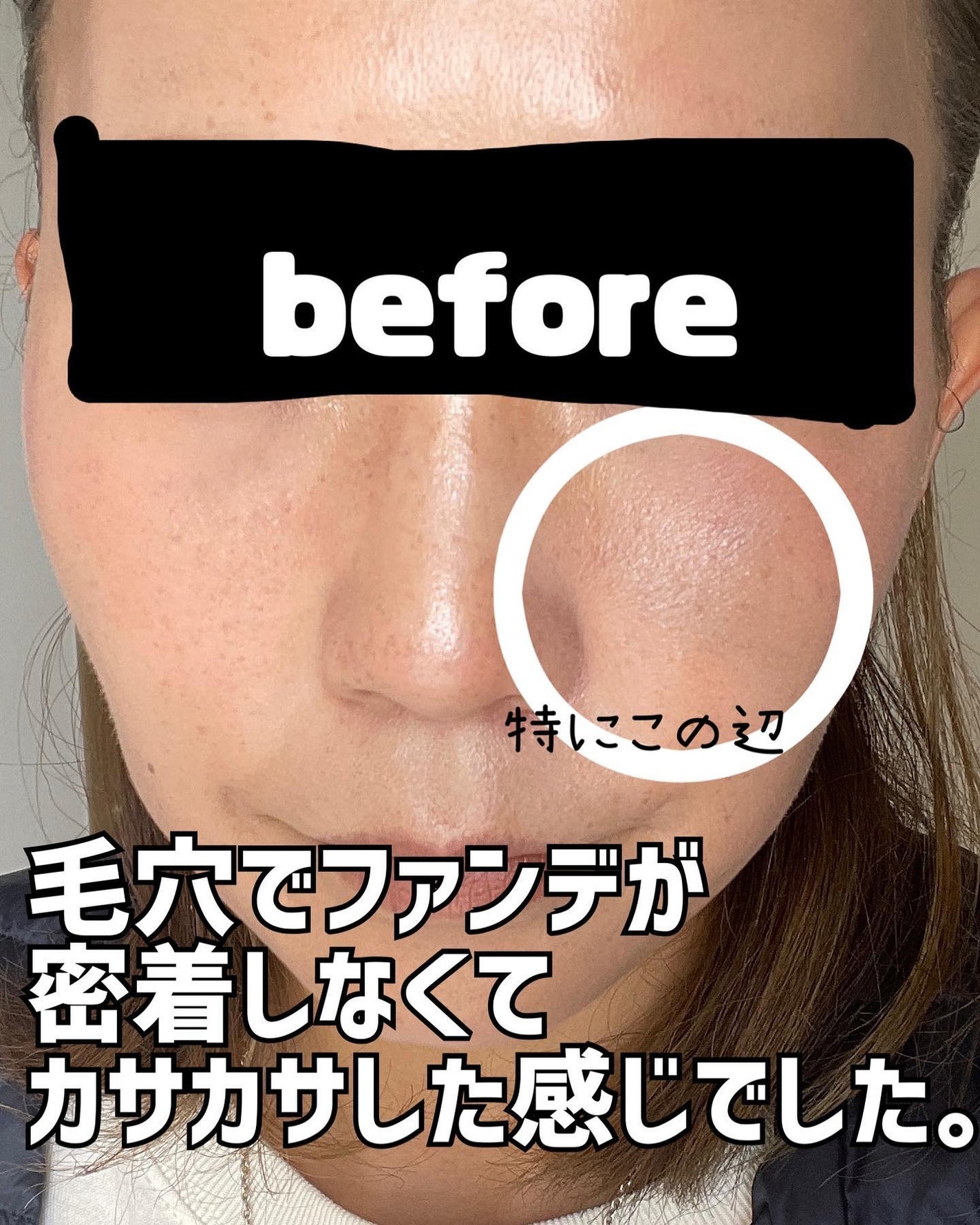 シカレチA エッセンス0.3/VT/美容液を使ったクチコミ(2枚目)