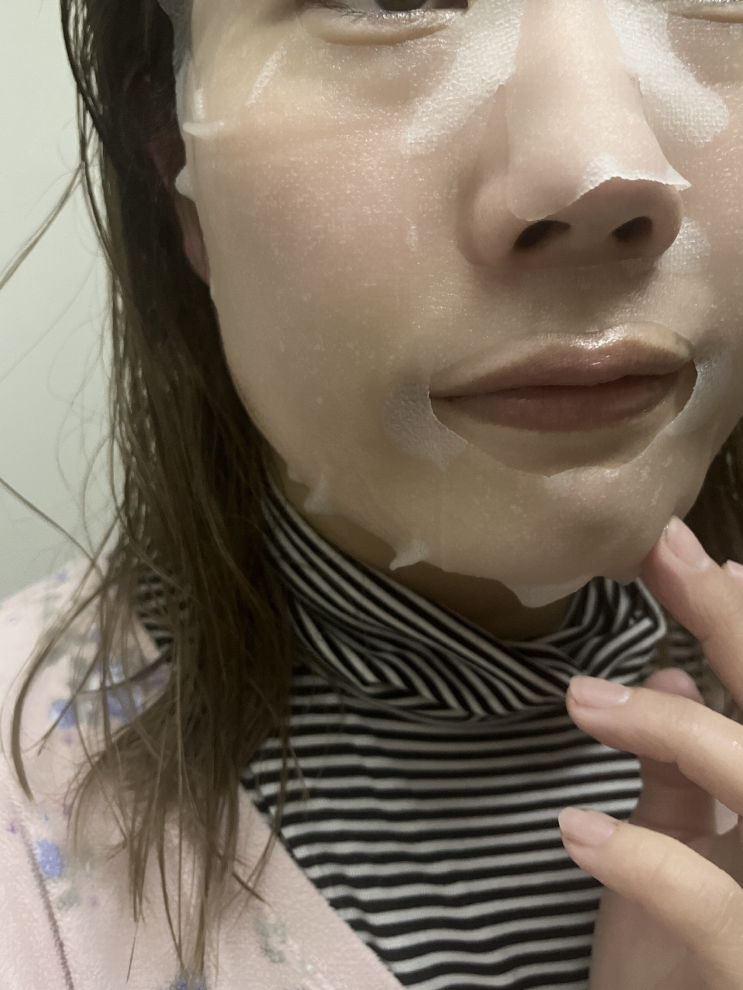 ダーマレーザー スーパーナイアシンアミド+ガラクトミセスマスク/クオリティファースト/その他スキンケアを使ったクチコミ（2枚目）