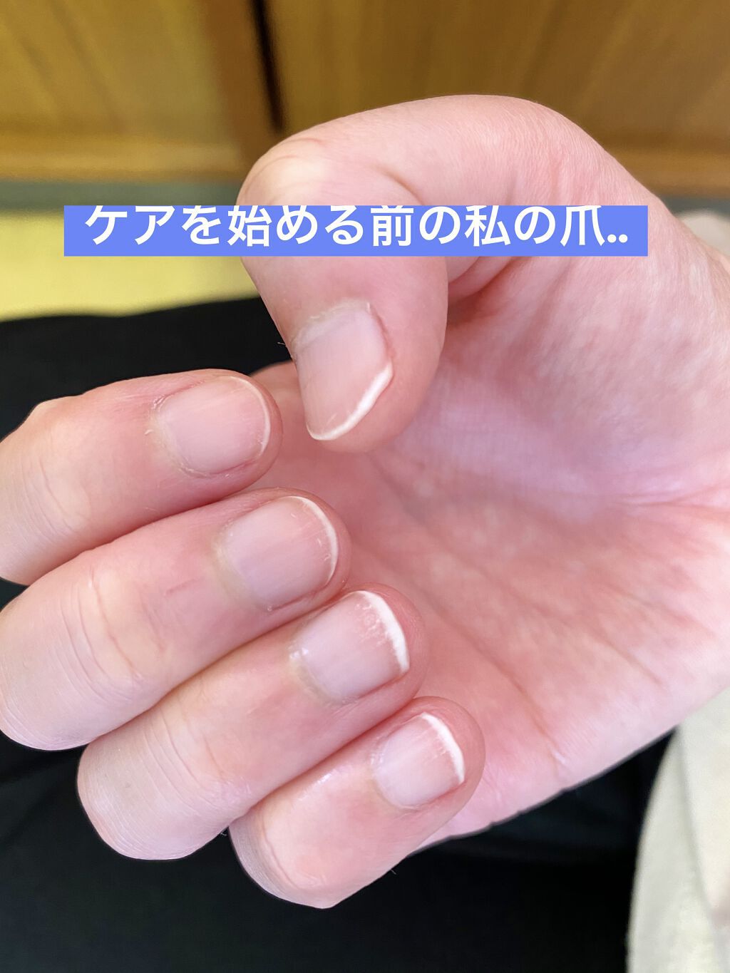 ネイルベッドオイル/アンドネイル/ネイルオイル・トリートメントを使ったクチコミ（2枚目）