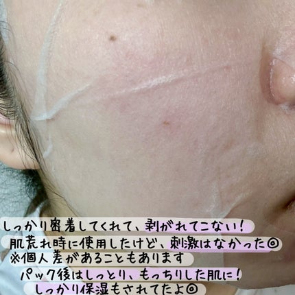 グルタシカ ブライトニングクイックマスク/Dr.Viuum/シートマスク・パックを使ったクチコミ(5枚目)