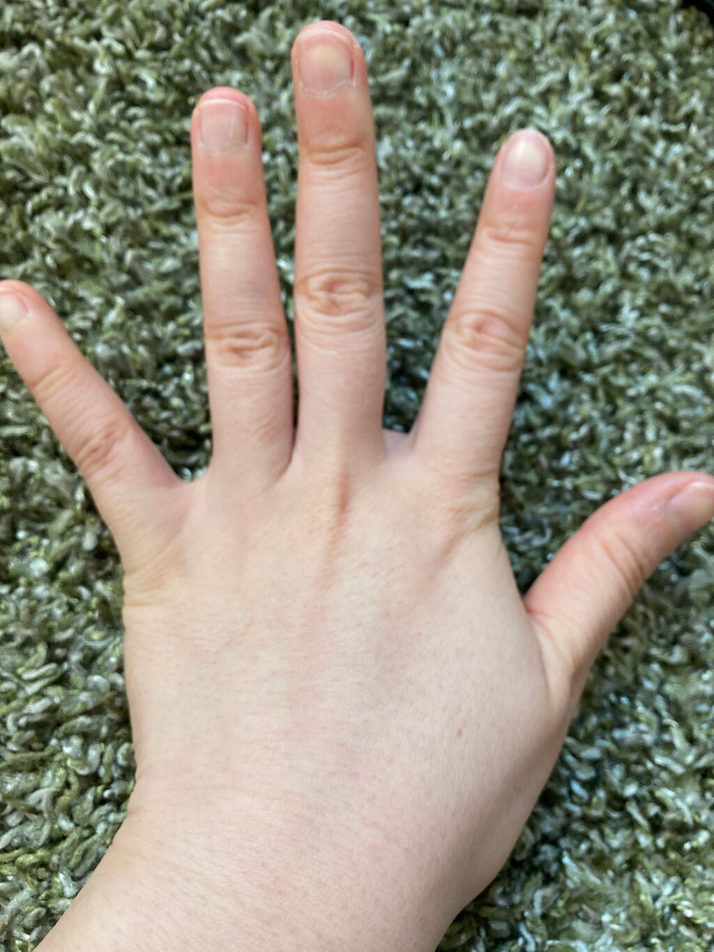 アイスレディ/icelady/家庭用脱毛器を使ったクチコミ(4枚目)