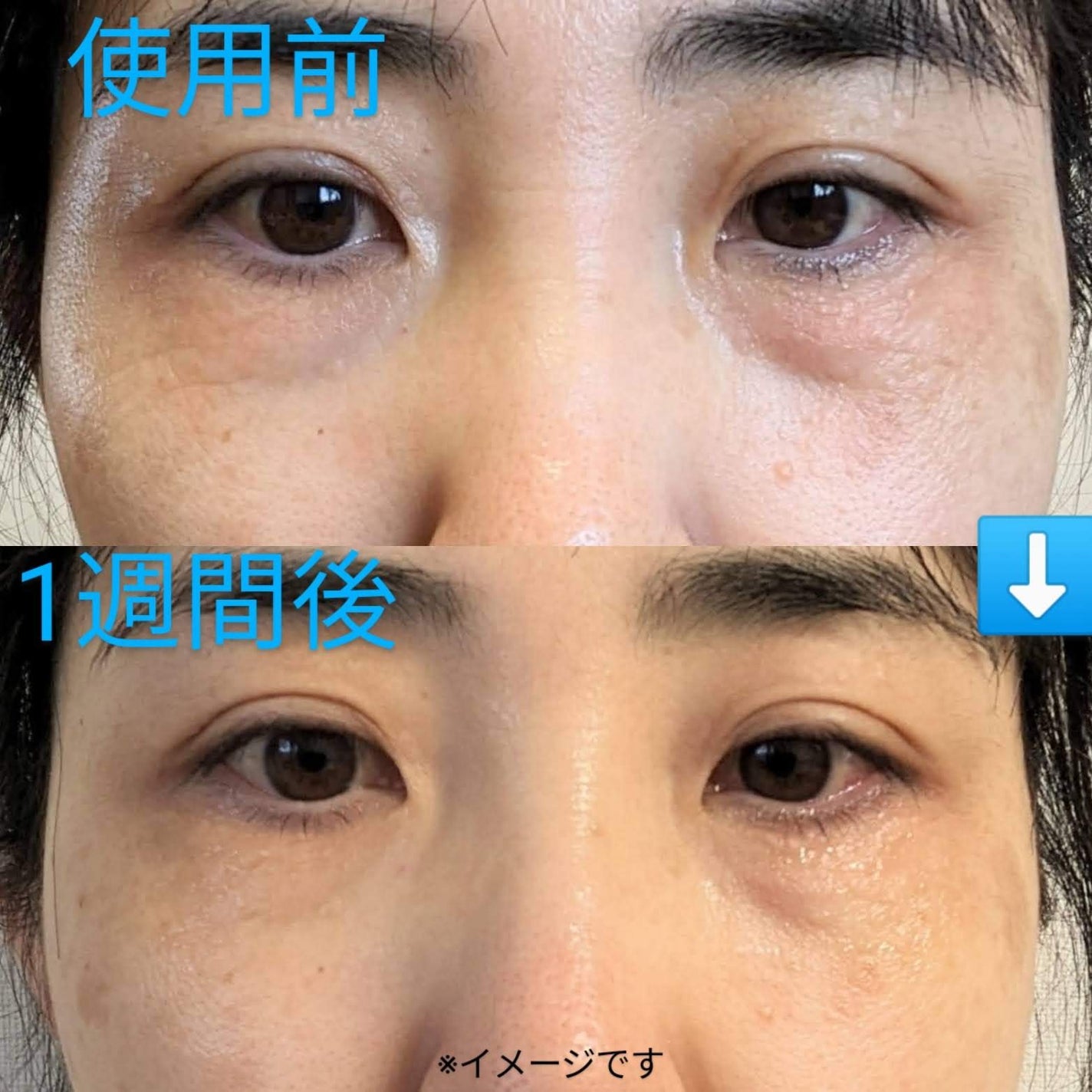 アットクリニック アルギニン E アイショットセラム/DOMINAS/アイケア・アイクリームを使ったクチコミ(2枚目)