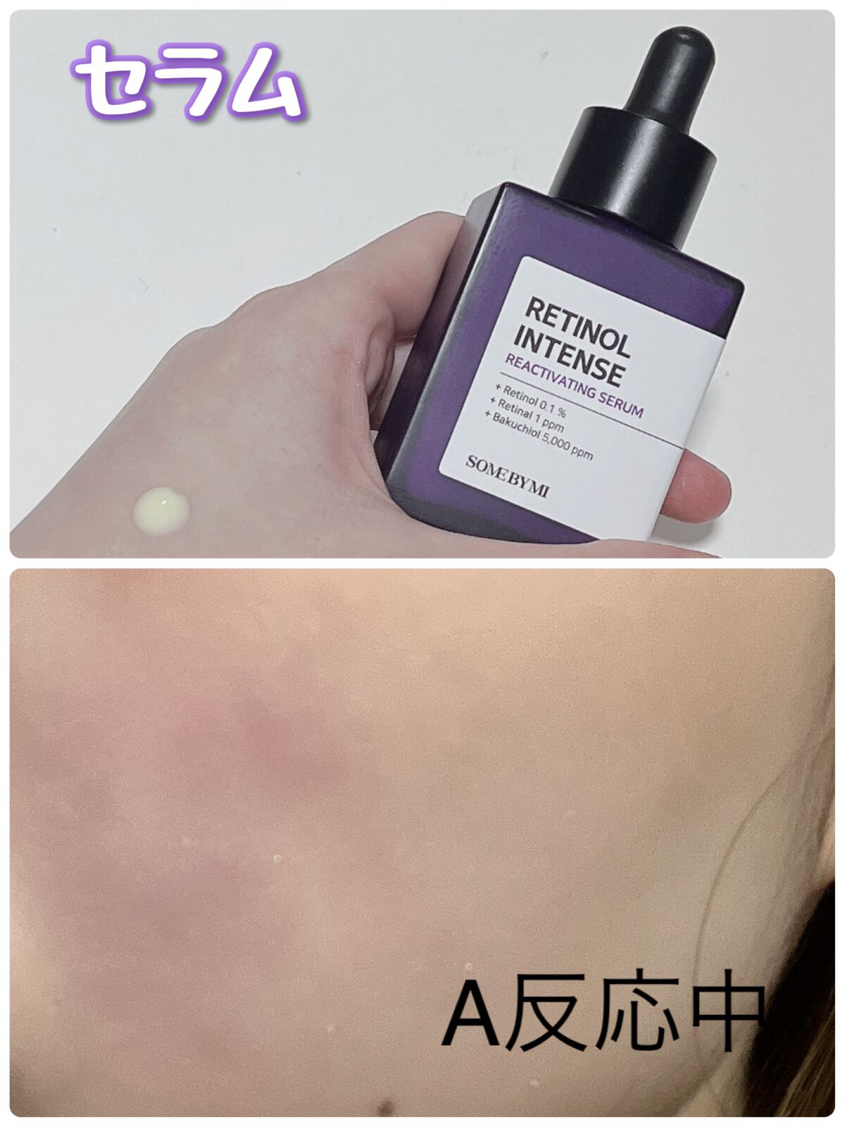 レチノールインテンスリアクティベーションセラム/SOME BY MI/美容液を使ったクチコミ(1枚目)