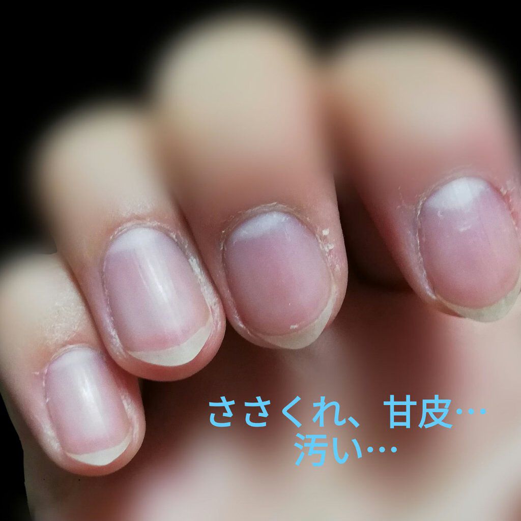 ニベアクリーム ニベアを使った口コミ こんにちは つい最近まで爪が汚かった私が By きなこもち 普通肌 10代後半 Lips