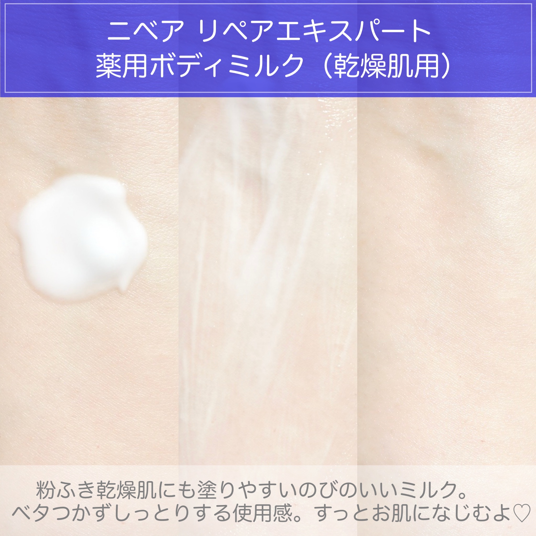 ニベア リペアエキスパート 薬用ボディミルク 乾燥肌用/ニベア/ボディミルクを使ったクチコミ（3枚目）