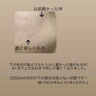 化粧水・敏感肌用・高保湿タイプ/無印良品/化粧水を使ったクチコミ（2枚目）