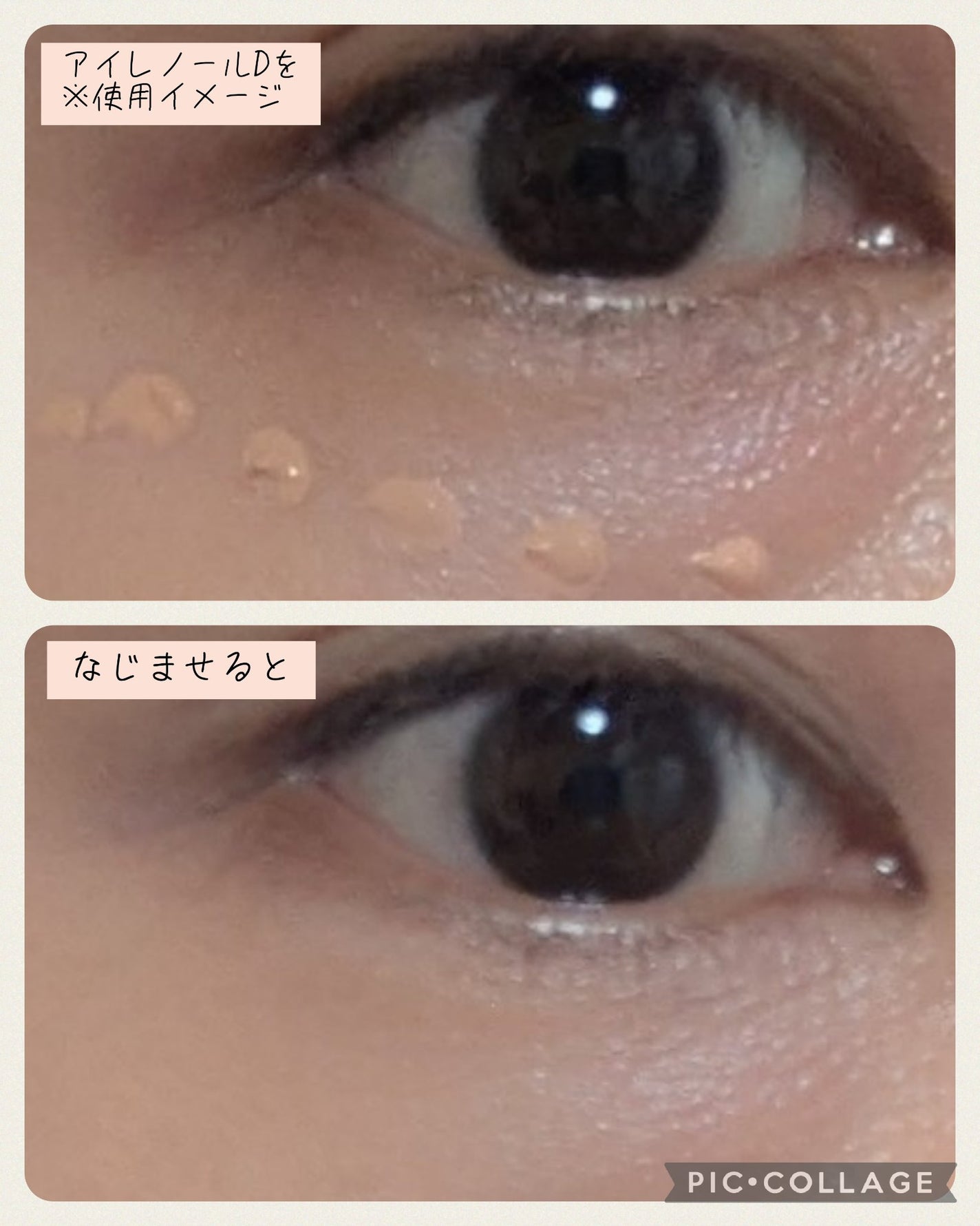 アイレノール クマクリーム/IRENOL/アイケア・アイクリームを使ったクチコミ(10枚目)