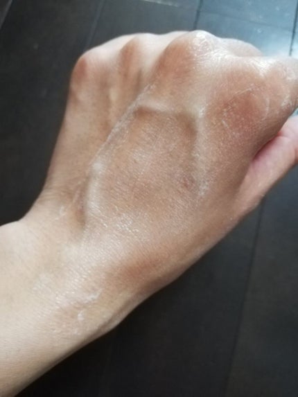 ティーツリーケア クレンジングフォーム JEX/MEDIHEAL/洗顔フォームを使ったクチコミ(4枚目)